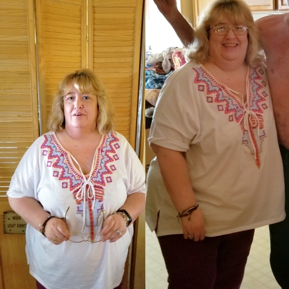 Before and after - Picture 2 of 6